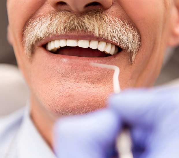 Carlsbad Adjusting to New Dentures