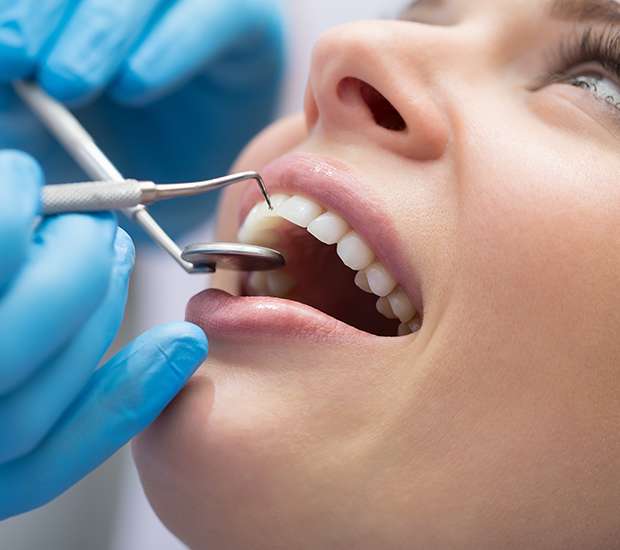 Carlsbad Dental Bonding