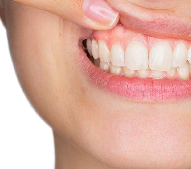 Carlsbad Gum Disease