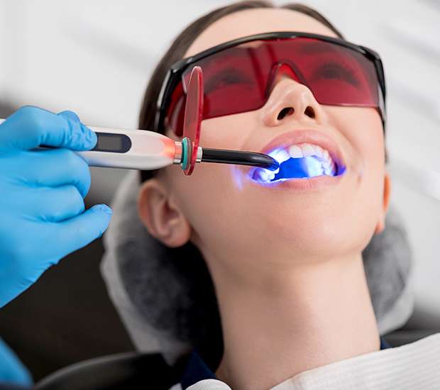 Carlsbad Professional Teeth Whitening