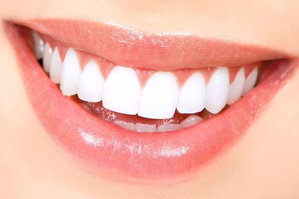 How Long Does Teeth Whitening Take from Ida Alfonso, DMD in Carlsbad, CA