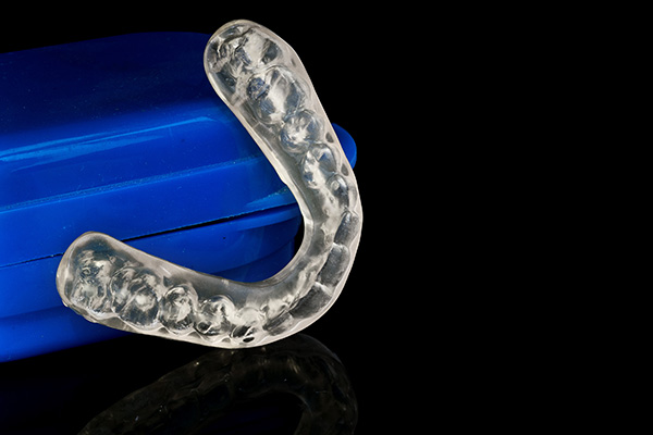 How Night Guards Prevent Excess Wear on Teeth from Ida Alfonso, DMD in Carlsbad, CA