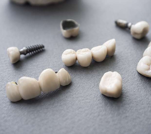 Carlsbad The Difference Between Dental Implants and Mini Dental Implants