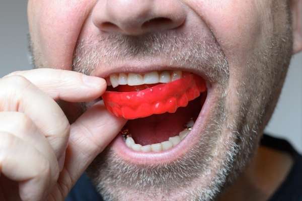 Save Your Teeth by Wearing Mouth Guards at Night from Ida Alfonso, DMD in Carlsbad, CA