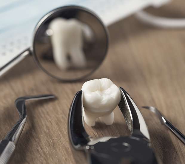 Carlsbad When Is a Tooth Extraction Necessary